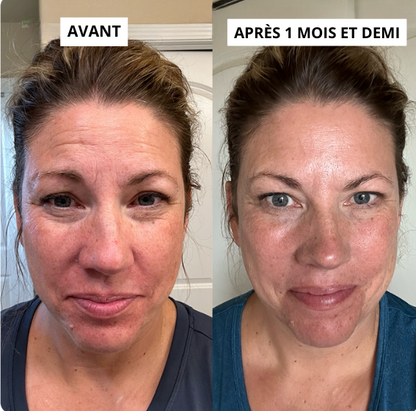 Kit de soin Micro-infusion